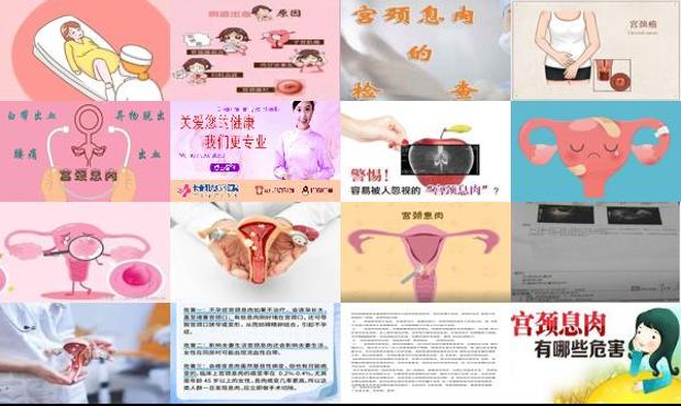 汕头宫颈息肉的危害