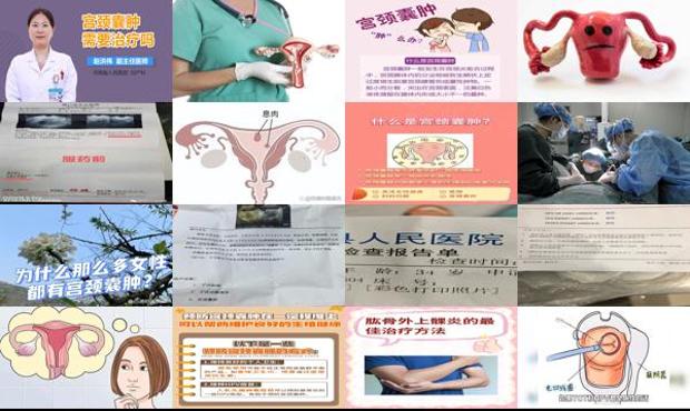 汕头宫颈**佳治疗方法