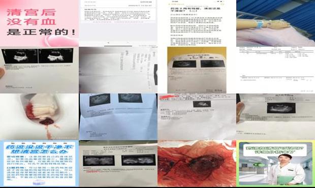 药流没流下来怎么办 - 汕头药流没流干净不想清宫