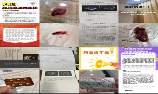 医院药流痛不痛 - 汕头药流痛不
