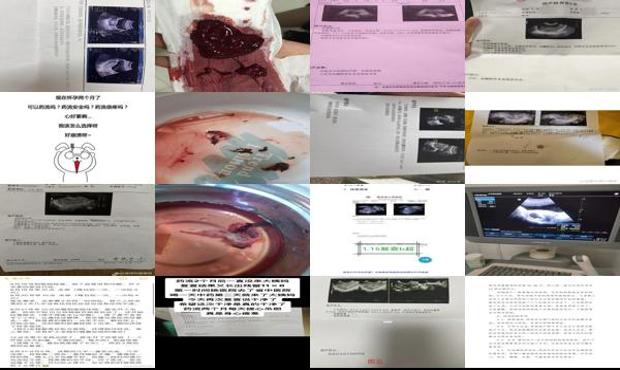 女生怀孕2个月 - 汕头怀孕2个多月可以药流吗