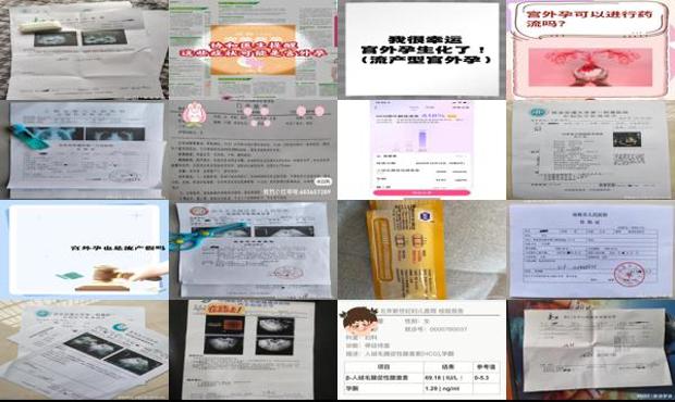 汕头怎么分辨宫外孕和流产
