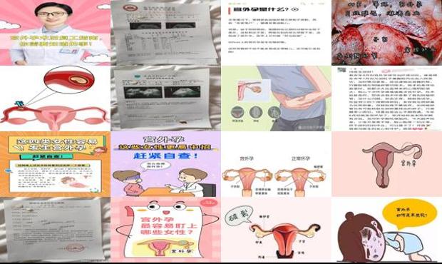 汕头女性宫外孕症状