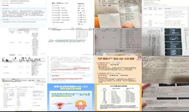 hCG参考值 - 汕头hcg值多少可能是宫外孕