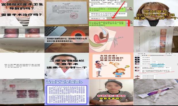 汕头做宫颈糜烂手术疼吗