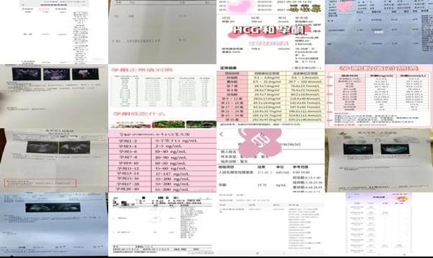 第五周孕酮值多少正常 - 汕头孕酮值多少是宫外孕