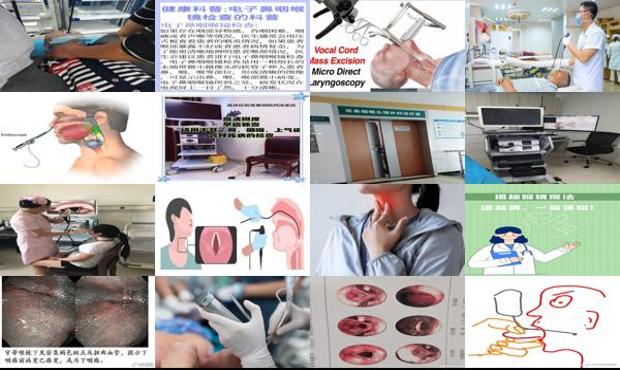 检查喉镜痛苦吗 - 汕头喉镜检查痛苦吗