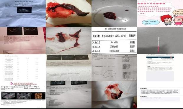 汕头怀孕10天怎么自然流产