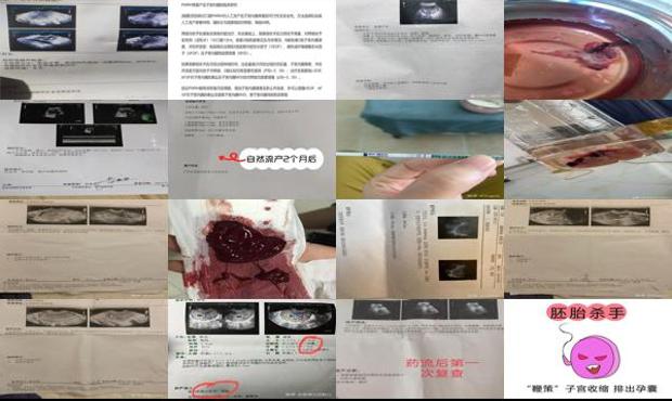 怀孕后两个月 - 汕头怀孕两个多月可以药流吗
