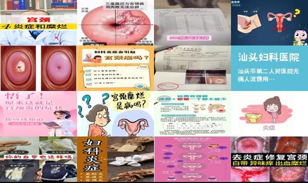 宫颈炎咨询 - 汕头宫颈炎症