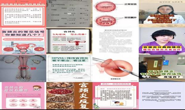 汕头宫颈炎该怎么治疗
