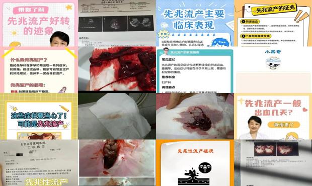 汕头先兆流产的症状