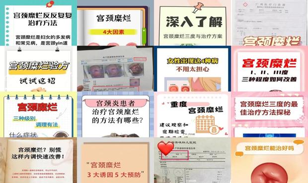 汕头重度宫颈糜烂怎么治疗