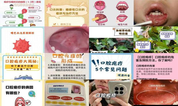 汕头鱼腥草妇科炎症