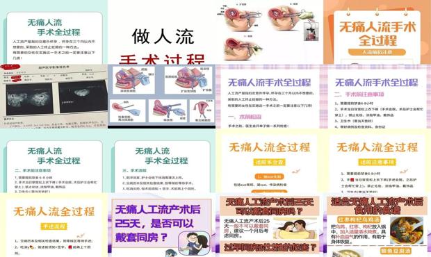 汕头*人流怎么做的过程图解